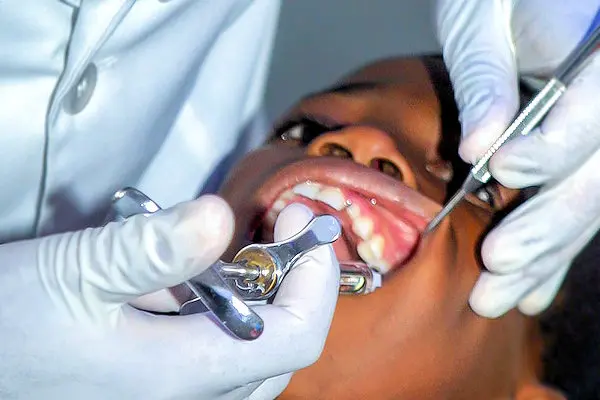 Hsd Services Extractions 1